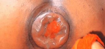 Cocked anal suction as I love it