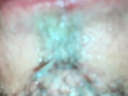 self facial on my braces and play with my cum