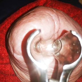 Speculum Inside My Cock Hole Made Me Cum