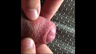 solobdsmman 34 i play whit my foreskin and my mole