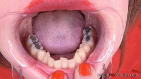 Inside My Mouth - Barbie - Mouth retractor inserted ( 4K quality )