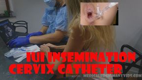 IUI cervix insemination hot girl