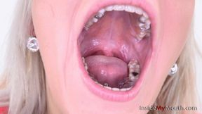 Inside My Mouth - Sandra Belle - Removable partial denture and mouth tour (FULLHD)