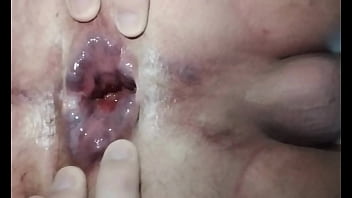 resultado do cu arrombado pela abobrinha