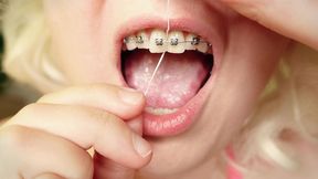 mouth fetish tour - cleaning - dental floss and teeth in braces