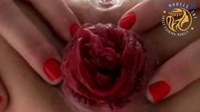 Real skank's gaping butt-hole prolapse climax
