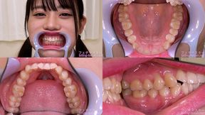 Rin Amasawa - Watching Inside mouth of Japanese cute girl - 1080p