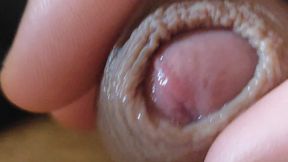 Large Foreskin and Balls in Striking Close-up.