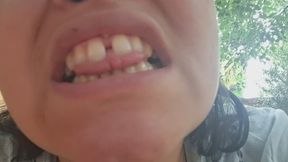 “Jugando con Mi Boca: Dientes, Úvula y Locura”