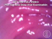 BEST Minicam Compilation in my Ass and Bladder - Get all Videos on Manyvids and Fansly!