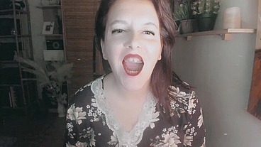 Dental bite braces