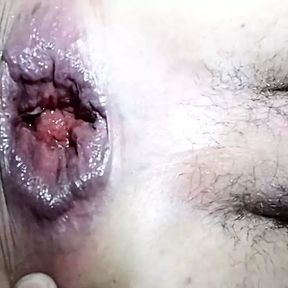 Closeup pom bottle anal gape