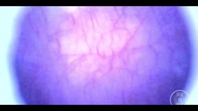 Beautiful Inside POV of My Full Bladder with the Endoscope!