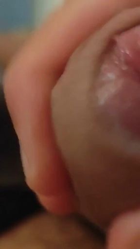 Great Phimosis Getting in the Way of the Boy's Orgasm