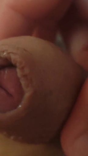 Great Phimosis Getting in the Way of the Boy's Orgasm