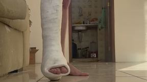 Waking up with a cast on my leg