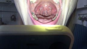 M to tuch the tonsils and uvula M