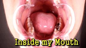 Inside my Mouth (iPhone)