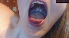 Inside My Mouth Sore Throat