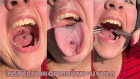 Inspection of mouth + uvula
