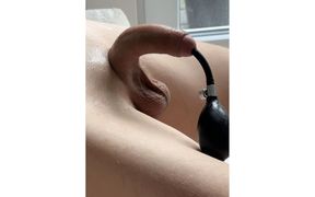 Inflating Bladder and Urethra During Sounding