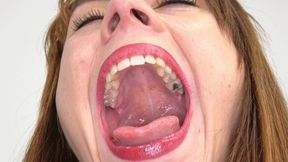 Mouth Fetish Extreme: Karolina's Super Wide Mouth, Big Wide Tongue, Long Uvula + Dental Exam (4K resolution)