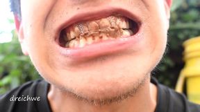 chocolate on the teeth