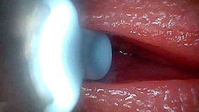 I couldn&#039;t believe what happens INSIDE the penis as sperm passes through (endoscopic footage)