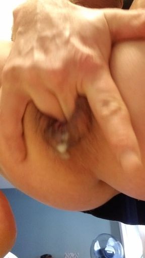 Prolapse squirting cum dump rosebud gaped ass hole analgasim