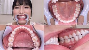 Kayo - Watching Inside mouth of Japanese cute girl BITE-163-1 - 1080p