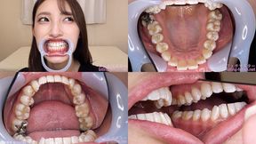 Kana - Watching Inside mouth of Japanese cute girl bite-238-1 - wmv