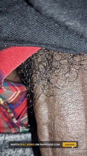 Close up on These Thick Veins