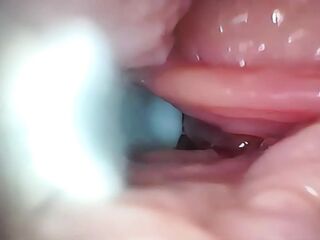 Sperm in Cervix Wide Stretching Snatch Endoscope!