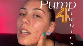 Pump for Pimples