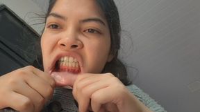 Jessie's extreme lip stretching