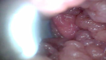 Endoscope camera shows the most sensitive parts of the penis Educational video