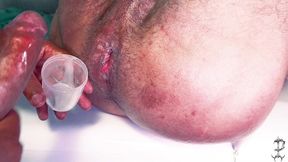 maloka ficou com vergonha de fazer o exame de espermograma