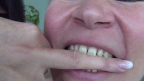 Victoria bites my hand and my fingers hard T