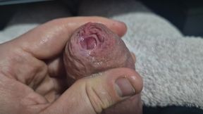 Uncut Tight Phimosis Cock Foreskin Stretched Close up