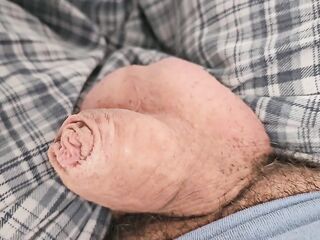 Soft to Soaked (UNCOMMON KNOB HEAD)