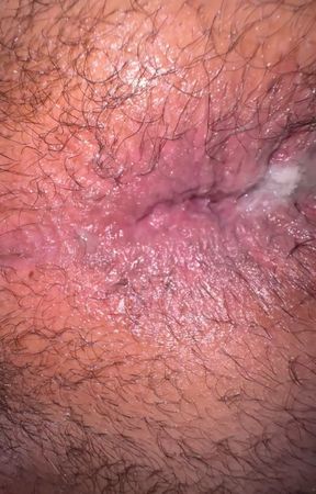 Fucking my asshole