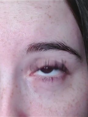 I Look at You and Cross My Eyes