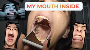My mouth inside