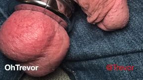 Ouch! Ball Weight Removal Gon Wrong