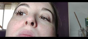 My Nose with Snot up Close