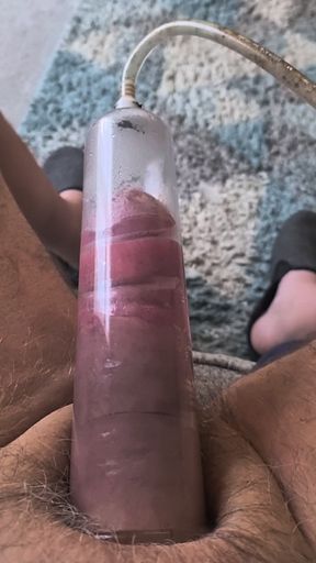 Too big  cock  Gloucester cock