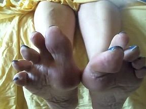 Mature wrinkled soles