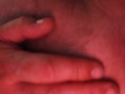 anal prolapse