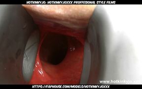 Sexy Blonde Nurse with Huge Speculum in Her Ass by Hotkinkyjo