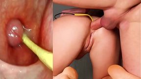 Hot anal&#x1F44C; cumshot with camera inside her tight hole and deep creampie
